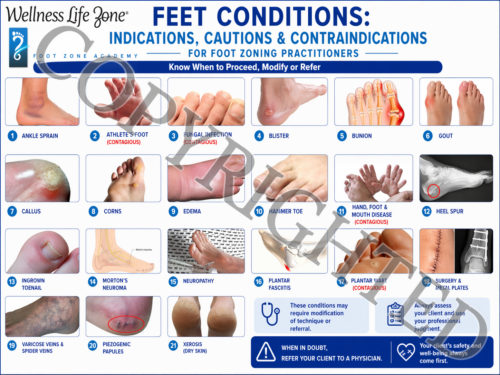 Feet Condtions