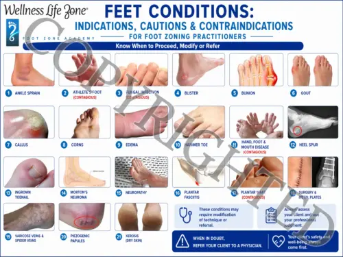 Feet Condtions