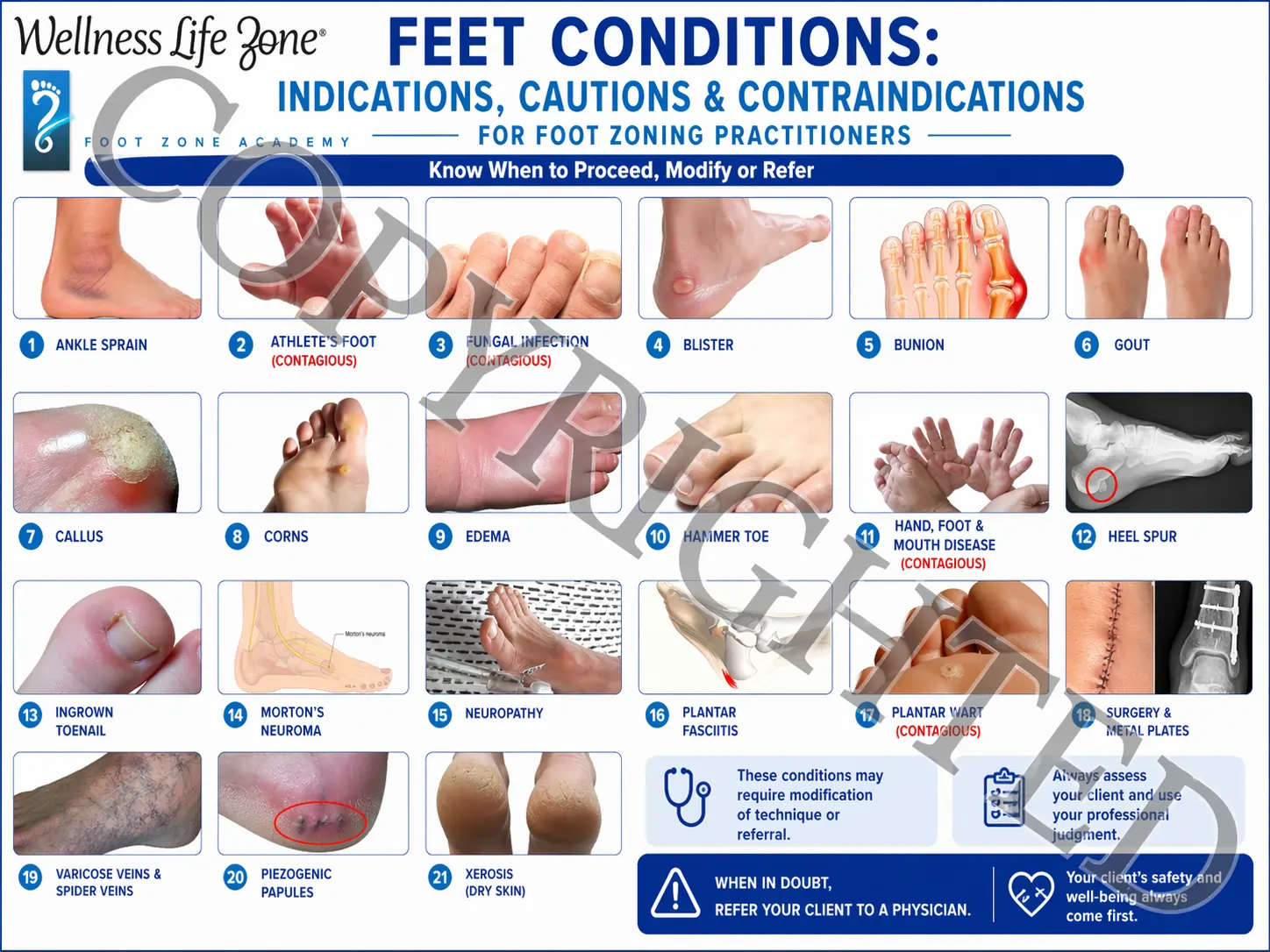 Feet Condtions